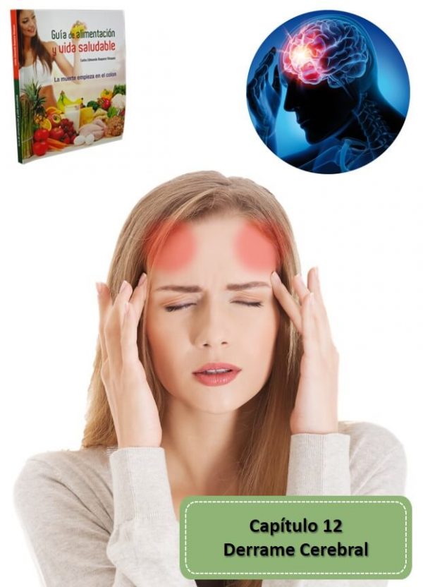 Capítulo 12 Derrame Cerebral Ebook Guía de Alimentación y Vida Saludable